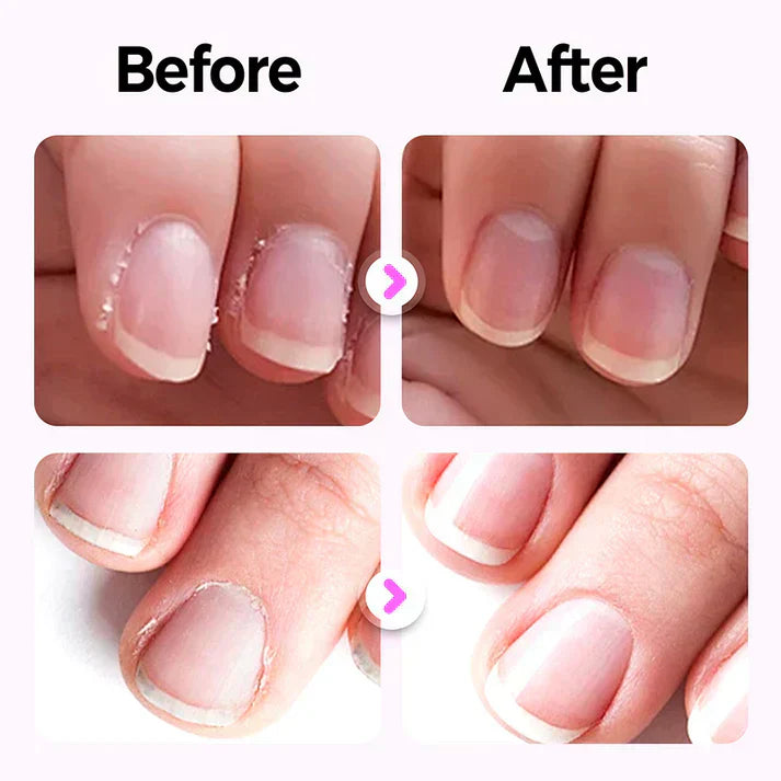 🔥Solange der Vorrat reicht 40 % Rabatt!🎉Universelle automatische Nagelfeile für Erwachsene und Kinder