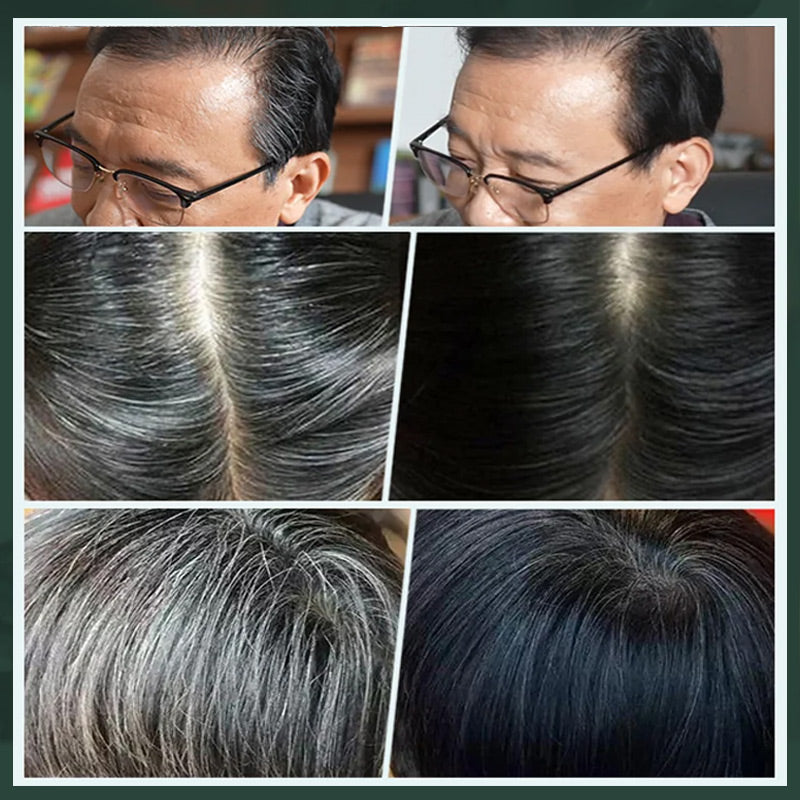 💇‍♀️ KAUFE 2. ERHALTE 1 GRATIS! ✨ Deutsche Pflanzenhaarfarbe für Salon-Perfekte Wurzeln – 100% Pflanzenkraft. Einfache Anwendung & Deckt Graues Haar In 5 Minuten 🌿